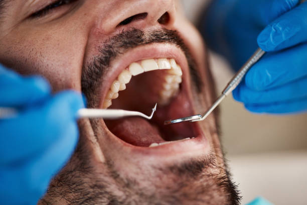 Best Emergency Dental Care for Abscessed Tooth in Parkwood, CA